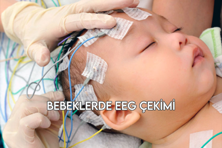 Bebeklere EEG Nasıl Çekilir?
