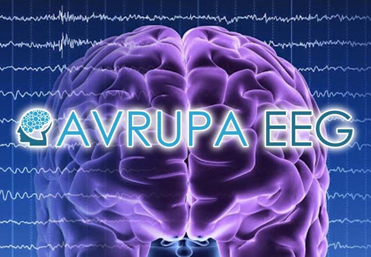 Avrupa EEG