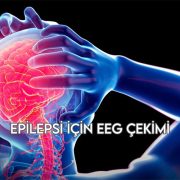 Epilepsi İçin EEG Çekimi