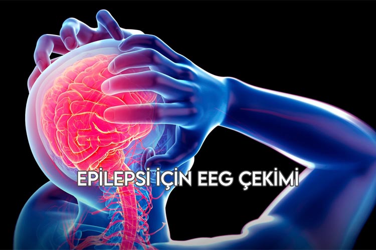 Epilepsi İçin EEG Çekimi