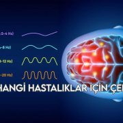 EEG Hangi Hastalıklar İçin Çekilir?