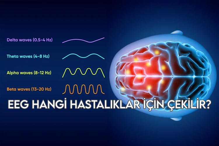 EEG Hangi Hastalıklar İçin Çekilir?